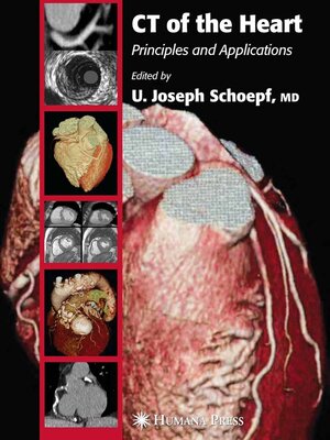 cover image of CT of the Heart